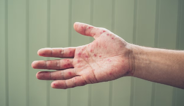 std symptoms in women,signs of std infection,early signs of stds,std effects on women,female infertility causes,syphilis during pregnancy,std detection,warning signs of stds,women’s health and stds,common stds in women