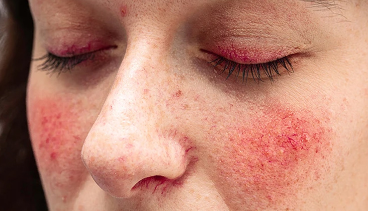 lesser-known beetroot beauty benefits,surprising beauty advantages of beetroot,beetroots hidden skincare benefits,beetroot for radiant skin,uncommon uses of beetroot for beauty,beetroots secret beauty properties,beauty hacks with beetroot,beetroots beauty magic,unexplored beauty benefits of beetroot,natural beauty with beetroot