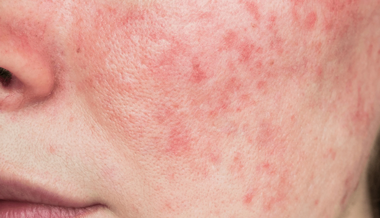 squalane oil benefits for skin,squalane oil skincare advantages,squalane oil for healthy skin,squalane oil beauty benefits,squalane oil for radiant skin,squalane oil anti-aging properties,benefits of squalane oil for complexion,natural skin benefits of squalane oil,squalane oil for moisturized skin,squalane oil skin rejuvenation