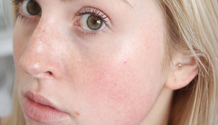 remedies to take care of skin during winters,skin care tips