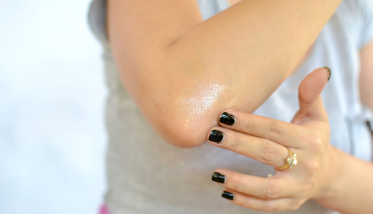 black elbow,home remedies,remedies for black elbow,beauty tips,skin care tips