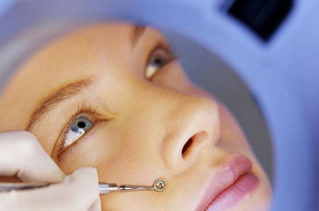 home remedies,home remedies for blackheads,blackheads,skin care tips,beauty tips