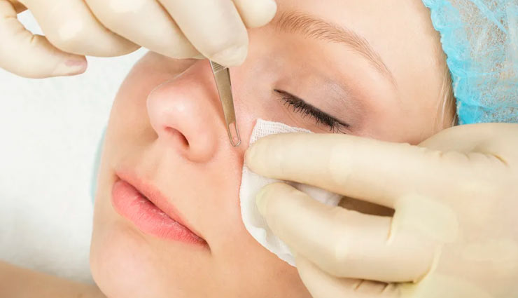 home remedies,home remedies for blackheads,blackheads,beauty tips,skin care tips