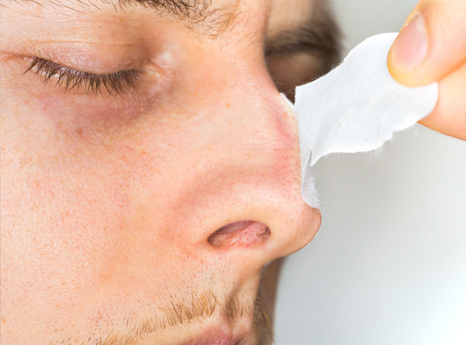 home remedies,home remedies for blackheads,blackheads,skin care tips,beauty tips