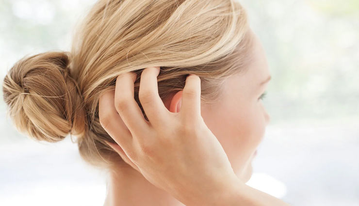 dandruff,home remedies,home remedies for dandruff,skin care tips,hair care tips,beauty tips