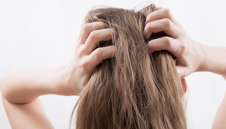 home remedies for dandruff,tips to get rid of dandruff,hair care tips,beauty tips