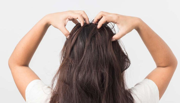 dandruff,home remedies,home remedies for dandruff,skin care tips,hair care tips,beauty tips