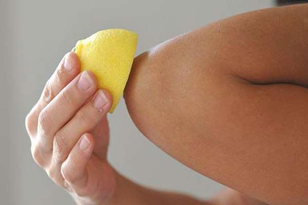 dark elbow,home remedies,skin care tips