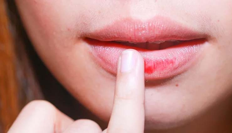 home remedies,home remedies for dark lips,tips to get rid of dark lips,lip care tips,beauty tips,skin care tips