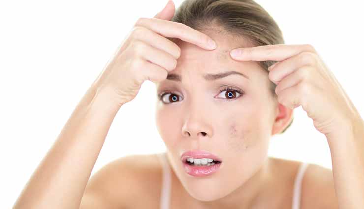 home remedies,home remedies for dark spots,skin care tips,beauty tips,simple beauty tips