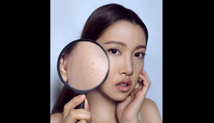 dark spots,home remedies for dark spots,skin care tips,beauty tips