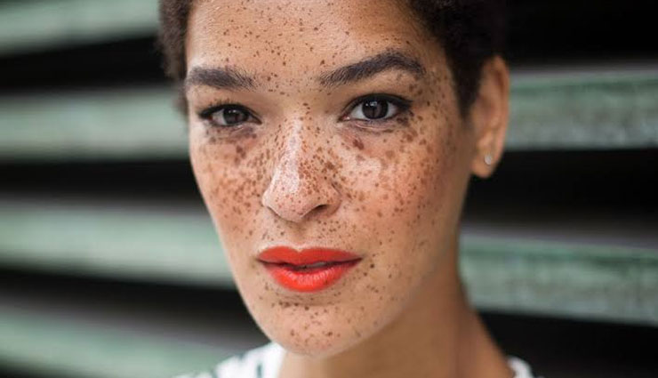 dark spots,remedies for dark spots,skin care tips,beauty tips