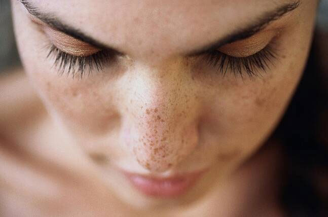 dark spots,home remedies for dark spots,skin care tips,beauty tips