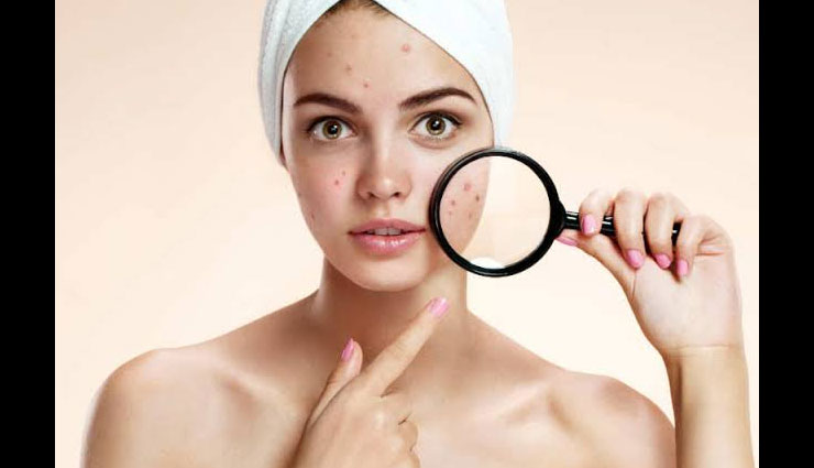 dark spots,remedies for dark spots,skin care tips,beauty tips