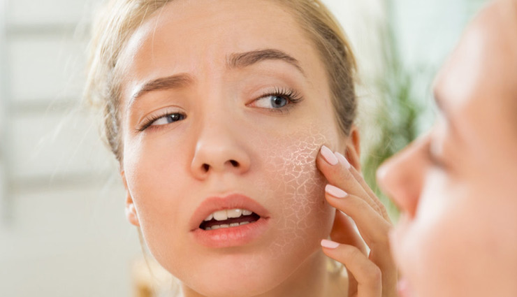 home remedies,dry skin,skin care tips,beauty tips