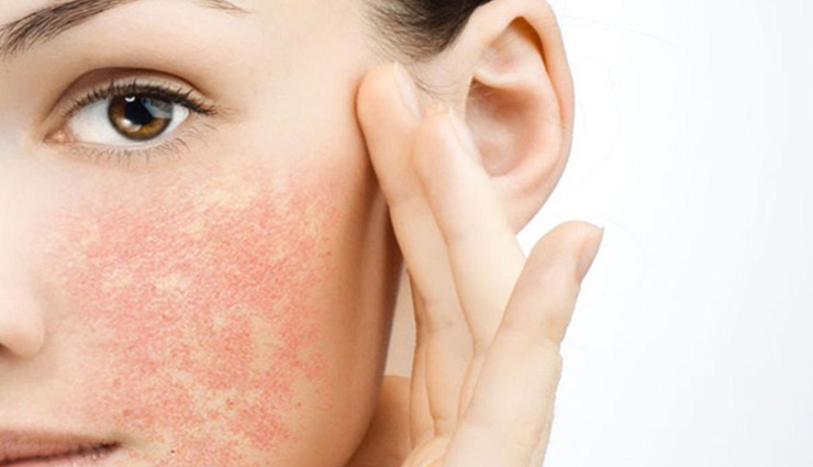 home remedies,dry skin,skin care tips,beauty tips