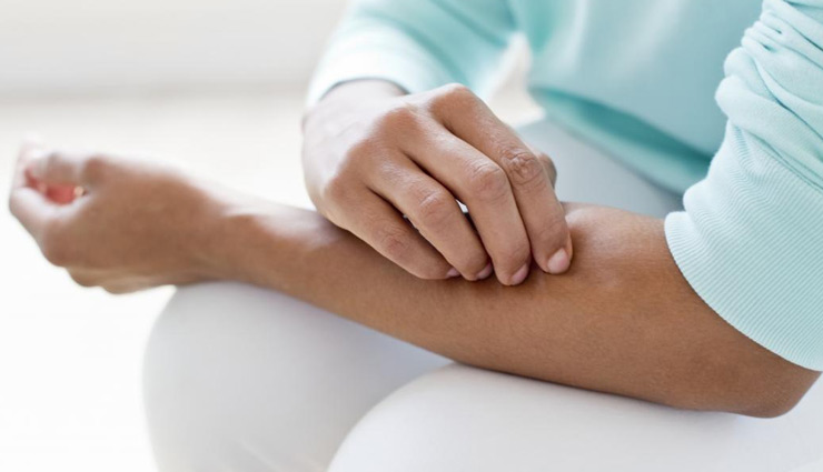 fungal infection,home remedies,home remedies for fungal infection