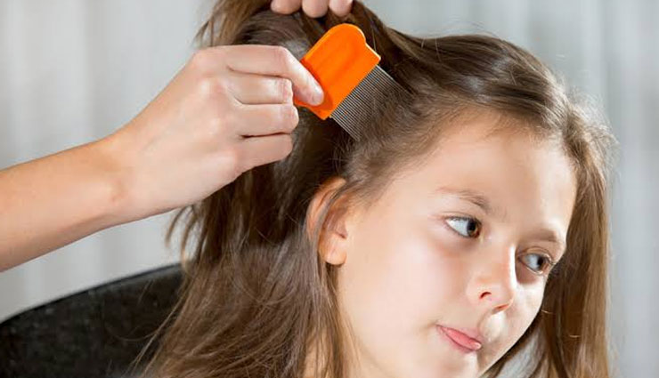 head lice,home remedies to get rid of head lice,beauty tips,hair care tips
