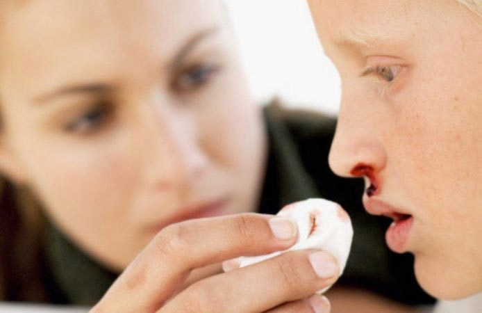 nose bleeding,home remedies,monsoon health tips,simple health tips,quick health tips