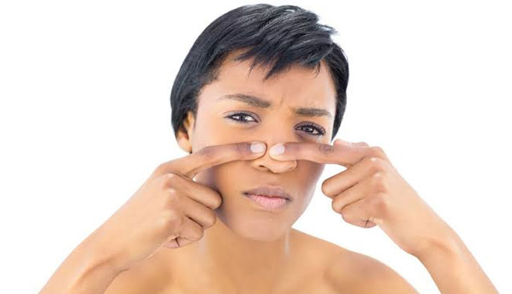 effective home remedies,home remedies,remedies for pimples,tips to get rid of pimples,beauty tips,skin care tips