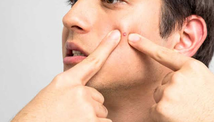 effective home remedies,home remedies,remedies for pimples,tips to get rid of pimples,beauty tips,skin care tips