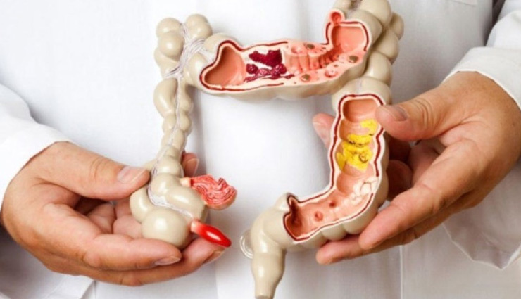 पेट के कीड़े बनते है कई बिमारियों की जड़, इस तरह करें जल्द उपचार