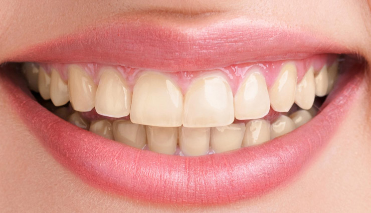 insects in teeth,remedies for insects in teeth,teeth care tips,Health tips