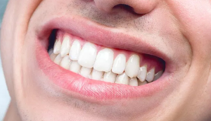 दांत के कीड़े पैदा करते है मुँह से जुड़ी कई समस्याएँ, इन घरेलू उपायों की मदद से पाएं इनसे निजात 