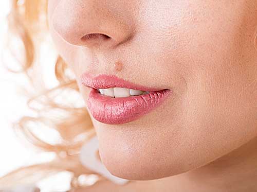 warts,home remedies,beauty tips,garlic,caster oil