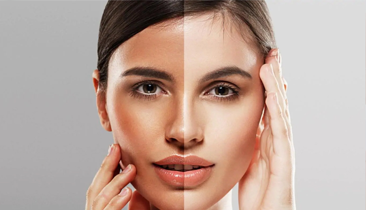 Here are 10 Best Ways To Remove Tan at Home