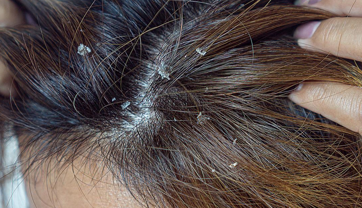 argan oil for hair benefits,benefits of using argan oil on hair,natural hair care with argan oil,hair strengthening with argan oil,moisturizing properties of argan oil for hair,argan oil and hair growth promotion,argan oil and hair damage repair,argan oil and hair frizz reduction,argan oil and hair breakage prevention,argan oil and hair split end prevention,argan oil and hair shine enhancement,argan oil and hair texture improvement,argan oil and scalp health,argan oil and hair color protection,argan oil and hair styling aid