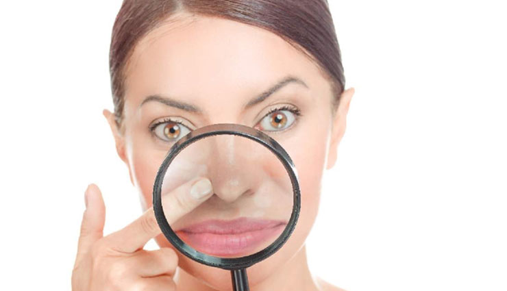 blackheads,home remedies,home remedies to remove blackheads,skin care tips,beauty tips