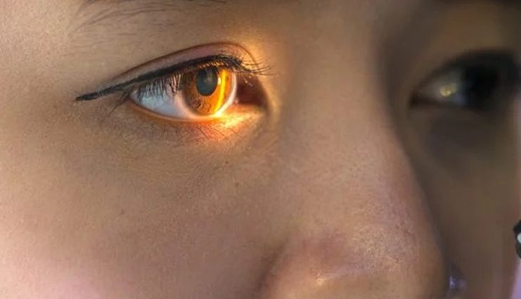 Health,healthy living,eyes,serious disease,Health tips