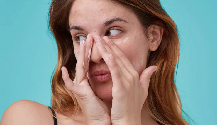 5 Remedies To Treat Retinol Purge at Home