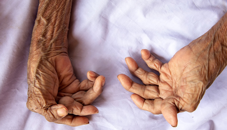 rheumatoid arthritis,measures to fight rheumatoid arthritis,Health tips,fitness tips