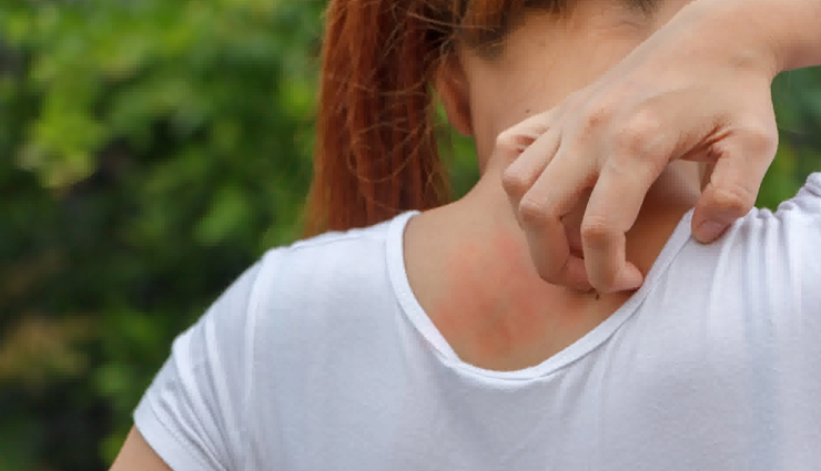 9 Effective Home Remedies To Treat Ringworm Infection