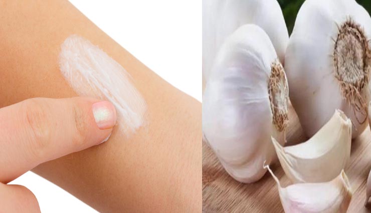 Health tips,health tips in hindi,ringworm,ringworm remedies,home remedies,remedies of ringworm