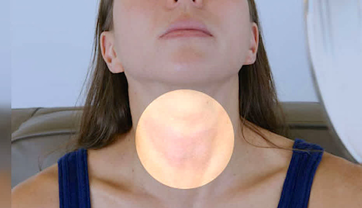 world thyroid day,ways to lower risk of hypothyroidism,hypothyroidism,Health tips,fitness tips
