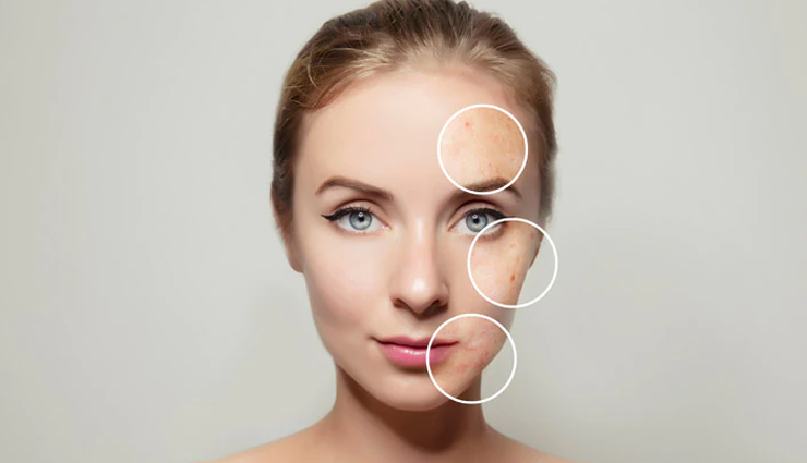 rose powder,beauty benefits of rose powder,skin care tips,beauty tips