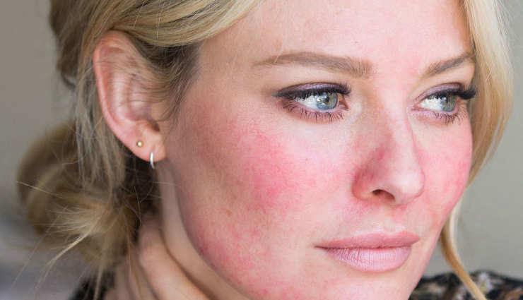 least known benefits of plantain for your skin,beauty tips,beauty hacks