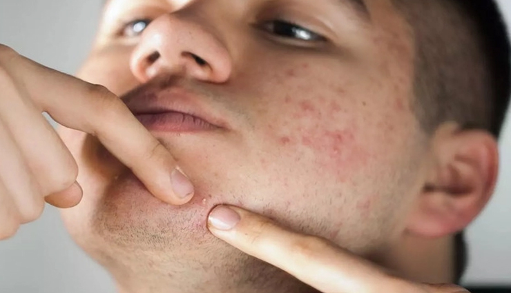 rose oil for skin and hair,beauty benefits of rose oil,skin care tips,hair care tips