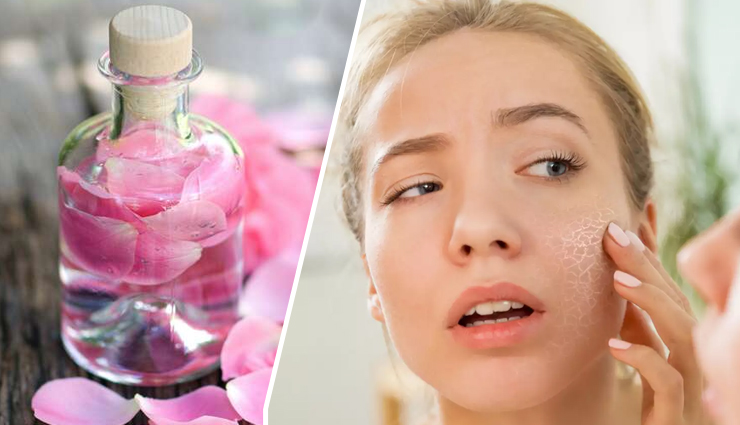 How To Use Rose Water For Dry Skin