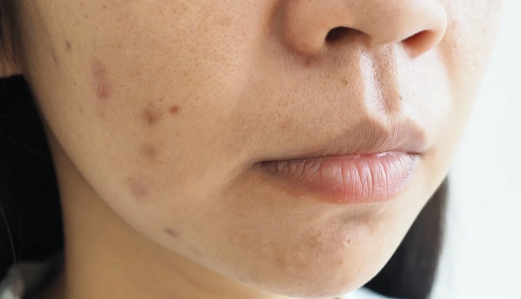 rosehip oil benefits for face,rosehip oil skincare benefits,rosehip oil for facial care,rosehip oil face treatment,how to use rosehip oil on face,rosehip oil for skin health,rosehip oil face moisturizer,rosehip oil anti-aging properties,rosehip oil for acne scars,best rosehip oil for face,rosehip oil facial benefits,rosehip oil skin rejuvenation,rosehip oil complexion enhancement,rosehip oil facial serum,rosehip oil facial massage,rosehip oil facial cleansing,rosehip oil for glowing skin,rosehip oil natural skincare,rosehip oil beauty routine,rosehip oil for blemishes