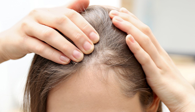 rosemary oil,beauty benefits of rosemary oil,rosemary oil for skin,rosemary oil for hair,beauty tips,skin care tips