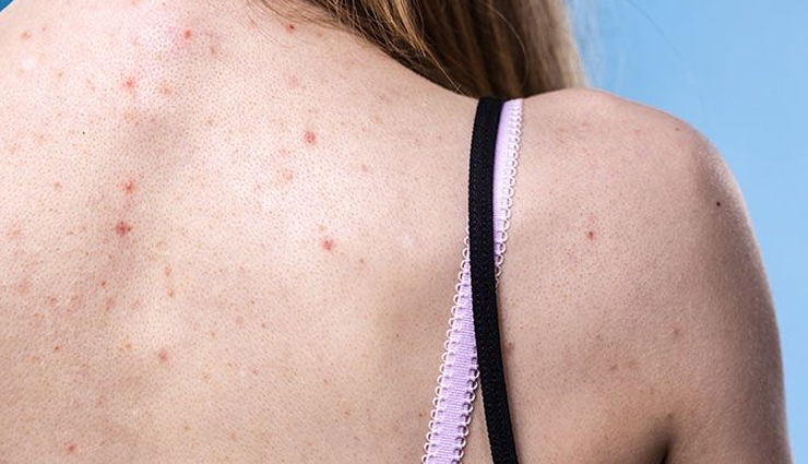 rosewater and glycerin for skin,skin care tips,beauty tips