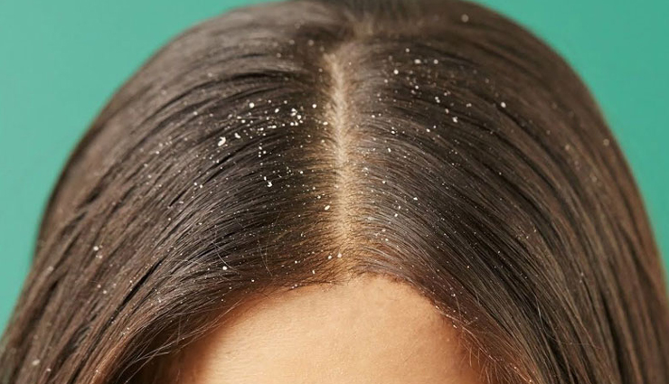 rose water is very useful for skin as well as hair,know its benefits,beauty tips,beauty hacks