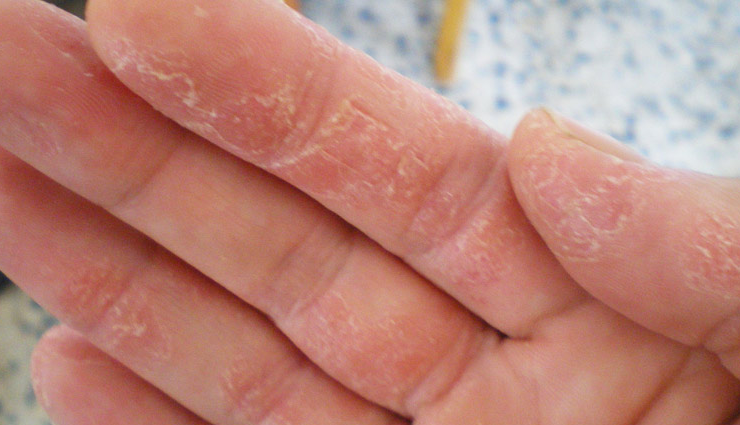 hot oil manicure benefits,beauty benefits of hot oil nails,hot oil treatment for nails,manicure with hot oil advantages,benefits of hot oil for nail care,nail health with hot oil manicure,hot oil nail treatment benefits,hot oil nail therapy advantages,nourishing nails with hot oil,hot oil manicure for nail health