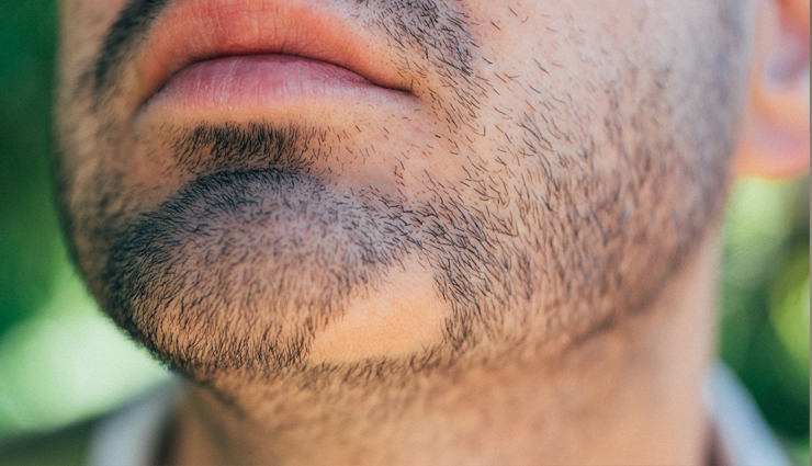 alopecia areata symptoms you should not ignore,beauty tips,beauty hacks