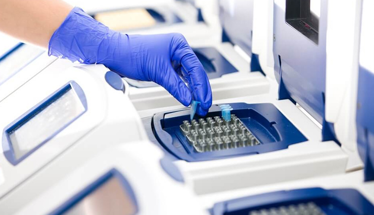 दिल्ली में मोबाइल वैन RT-PCR लैब शुरू, सिर्फ 499 रुपए में हो सकेगी जांच, 6 घंटे के अंदर आ जाएगी रिपोर्ट