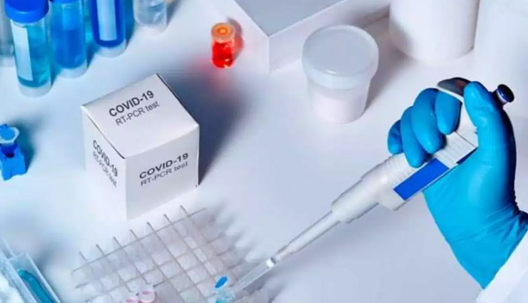 वाराणसी: फंड्स की कमी के चलते BHU में कोरोना की RT-PCR टेस्ट बंद 